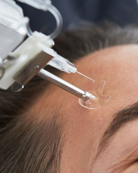 Formation Mésogun : mésothérapie méthode mésogun visage et capillaire